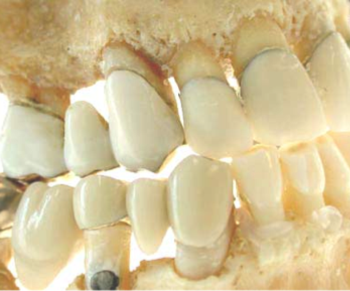 odontology-teeth-forensic-dentistry-career-science